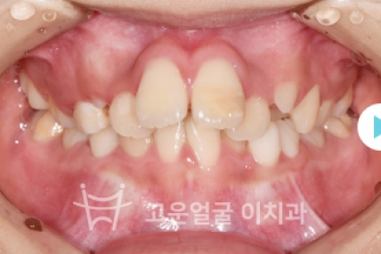 치료후기 이미지